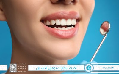 ابتسامة هوليود في جدة – أحدث ابتكارات تجميل الأسنان لعام 2025