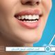 أحدث ابتكارات تجميل الأسنان