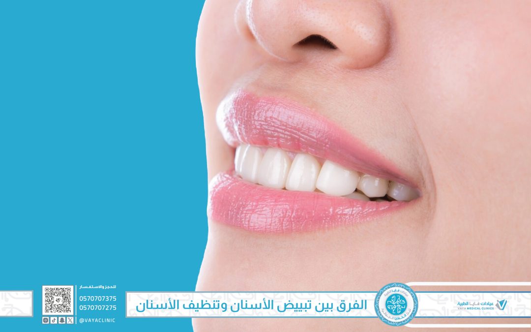الفرق بين تبييض الأسنان وتنظيف الأسنان