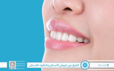 الفرق بين تبييض الأسنان وتنظيف الأسنان