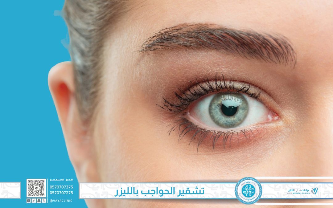 كل ما تريد معرفته عن تشقير الحواجب بالليزر في عيادات فايا الطبية