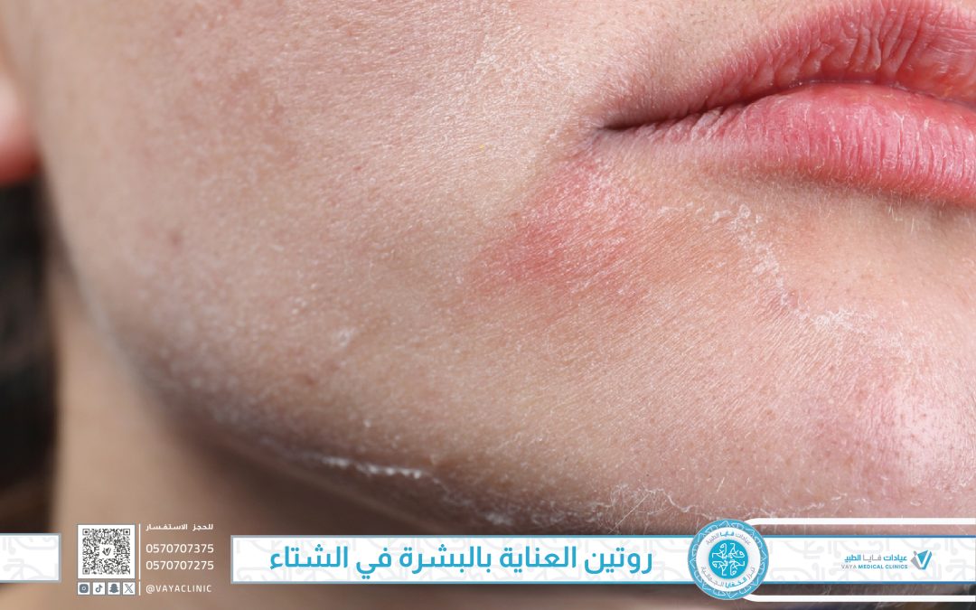 روتين العناية بالبشرة في الشتاء – نصائح مقدمة من فايا من دليل العناية بالبشرة