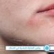 روتين العناية بالبشرة في الشتاء