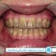 أسباب تصبغات الاسنان وطرق علاجها