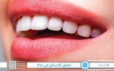 أفضل عيادة تجميل اسنان في جدة – عيادات فايا الطبية