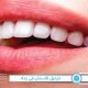 أفضل عيادة تجميل الاسنان في جدة