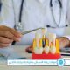 مقارنة زراعة الاسنان بالبدائل