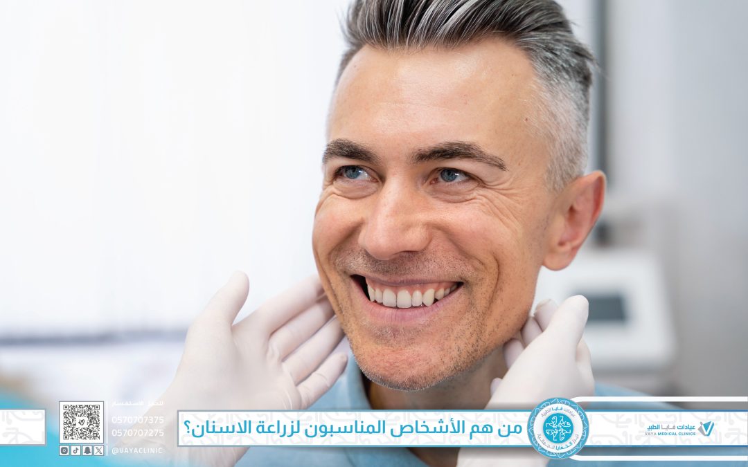 من هم الأشخاص المناسبون لزراعة الاسنان؟ دليل لتحديد أهلية الزراعة بسهولة