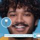 الفرق بين زراعة الأسنان الفوية والتقليدية