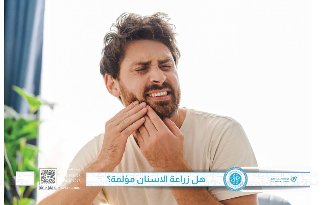 هل زراعة الاسنان مؤلمة؟ كل ما تريد معرفته عن الألم وطرق التعامل معه