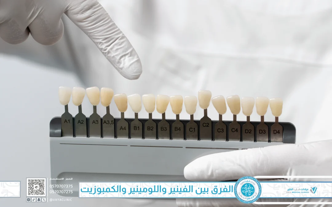 الفرق بين الفينير واللومينير والكمبوزيت في جدة: أيهما يناسب ابتسامتك؟