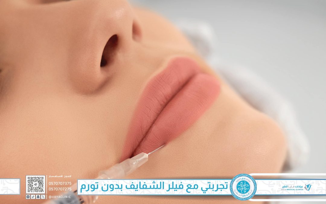 تجربتي مع فيلر الشفايف في جدة بدون تورم: السر في تقنية الحقن المتقدمة في عيادات فايا