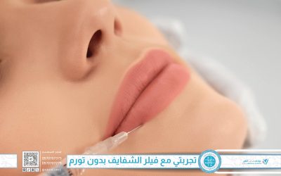 تجربتي مع فيلر الشفايف في جدة بدون تورم: السر في تقنية الحقن المتقدمة في عيادات فايا