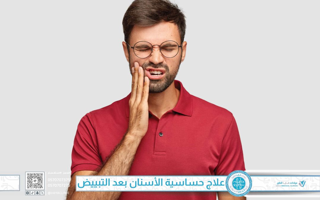 علاج حساسية الأسنان بعد التبييض في جدة – دليلك الشامل من عيادات فايا الطبية